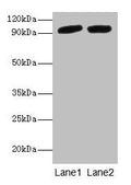 POSTN Antibody – Figure 1 of 4