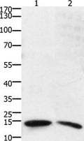 Gel: 15%+12%SDS-PAGE Lysates (from left to right): Human small intestine stromal cancer tissue Amount of lysate: 40ug per lane Primary antibody: 1/800 dilution Secondary antibody dilution: 1/8000 Exposure time: 10 seconds