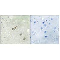 Immunohistochemistry analysis of paraffin-embedded human brain tissue, using DGKK antibody.