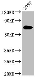 Western Blot
Positive WB detected in: 293T whole cell lysate
All lanes: AFP antibody at 3.2µg/ml
Secondary
Goat polyclonal to rabbit IgG at 1/50000 dilution
Predicted band size: 69 kDa
Observed band size: 69 kDa