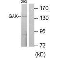 Western blot analysis of extracts from 293 cells, using GAK antibody.
