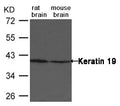 Western blot analysis of extract from rat and mouse brain tissue using Keratin 19 Antibody