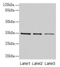 Western blot
All lanes: GDF15 antibody at 4µg/ml
Lane 1: HepG2 whole cell lysate
Lane 2: Human placenta tissue
Lane 3: A549 whole cell lysate
Secondary
Goat polyclonal to rabbit IgG at 1/10000 dilution
Predicted band size: 35 kDa
Observed band size: 35 kDa