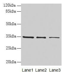 Western blot
All lanes: GDF15 antibody at 4µg/ml
Lane 1: HepG2 whole cell lysate
Lane 2: Human placenta tissue
Lane 3: A549 whole cell lysate
Secondary
Goat polyclonal to rabbit IgG at 1/10000 dilution
Predicted band size: 35 kDa
Observed band size: 35 kDa