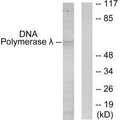 Western blot analysis of extracts from 293 cells, using DNA Polymerase ^I>> antibody.