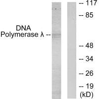 Western blot analysis of extracts from 293 cells, using DNA Polymerase ^I>> antibody.