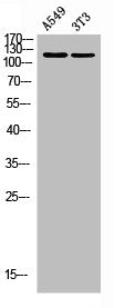 Western blot analysis of A549 3T3 using Tensin-2 antibody. Antibody was diluted at 1:500. Secondary antibody  was diluted at 1:20000