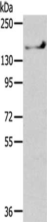 Gel: 6%SDS-PAGE,Lysate: 40 ug,,Primary antibody: CSB-PA100838(SHANK1 Antibody) at dilution 1/200 dilution,Secondary antibody: Goat anti rabbit IgG at 1/8000 dilution,Exposure time: 1 minute