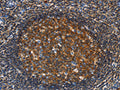 The image on the left is immunohistochemistry of paraffin-embedded Human tonsil tissue using CSB-PA101118(GNA13 Antibody) at dilution 1/30, on the right is treated with fusion protein. (Original magnification: ×200)