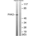 Western blot analysis of extracts from HepG2 cells, treated with serum (20%, 15mins), using PAK2 (Ab-192) antibody.