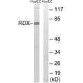 Western blot analysis of extracts from HuvEc cells, using RDX antibody.
