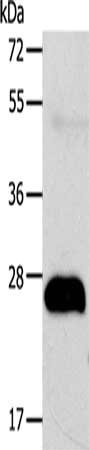 Gel: 12%SDS-PAGE, Lysate: 40 ug, Lane: Human fetal liver cancer tissue, Primary antibody: CSB-PA101475(AGPAT2 Antibody) at dilution 1/400, Secondary antibody: Goat anti rabbit IgG at 1/8000 dilution, Exposure time: 30 seconds
