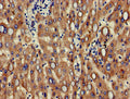 Immunohistochemistry of paraffin-embedded human liver tissue using CSB-PA10209A0Rb at dilution of 1:100