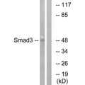 Western blot analysis of extracts from HUVEC cells, using Smad3 (Ab-204) antibody.