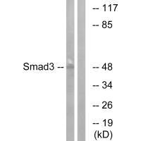 Western blot analysis of extracts from HUVEC cells, using Smad3 (Ab-204) antibody.