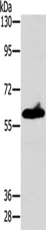 Gel: 8%SDS-PAGE, Lysate: 40 ug, Lane: A549 cells, Primary antibody: CSB-PA103751(ASB3 Antibody) at dilution 1/200, Secondary antibody: Goat anti rabbit IgG at 1/8000 dilution, Exposure time: 10 seconds