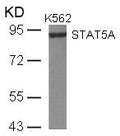 Western blot analysis of extracts from K562 cells using STAT5A(Ab-780) Antibody.