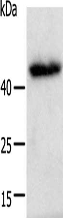Gel: 12+15%SDS-PAGE, Lysate: 40 ug, Lane: A549 cells, Primary antibody: CSB-PA103911(E2F2 Antibody) at dilution 1/600, Secondary antibody: Goat anti rabbit IgG at 1/8000 dilution, Exposure time: 10 minutes