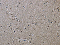The image on the left is immunohistochemistry of paraffin-embedded Human brain tissue using CSB-PA104816(HSPA9 Antibody) at dilution 1/50, on the right is treated with fusion protein. (Original magnification: ×200)