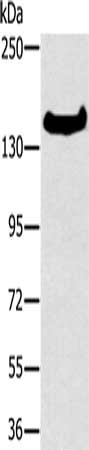 Gel: 6%SDS-PAGE, Lysate: 40 ug, Lane: A172 cells, Primary antibody: CSB-PA104902(FMNL1 Antibody) at dilution 1/350, Secondary antibody: Goat anti rabbit IgG at 1/8000 dilution, Exposure time: 40 seconds