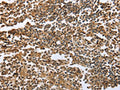 The image on the left is immunohistochemistry of paraffin-embedded Human tonsil tissue using CSB-PA105007(ECE1 Antibody) at dilution 1/60, on the right is treated with fusion protein. (Original magnification: ×200)
