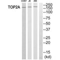 Western blot analysis of extracts from HT-29 cells, using TOP2A antibody.