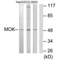 Western blot analysis of extracts from HepG2 cells, COLO205 cells and 293 cells, using MOK antibody.