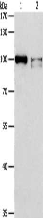 Gel: 8%SDS-PAGE, Lysate: 40 ug, Lane 1-2: K562 cells, Jurkat cells, Primary antibody: CSB-PA105677(ADAMTSL2 Antibody) at dilution 1/350, Secondary antibody: Goat anti rabbit IgG at 1/8000 dilution, Exposure time: 5 minutes