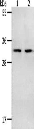 Gel: 10%SDS-PAGE, Lysate: 40 ug, Lane 1-2: Mouse spleen tissue, Mouse intestinum crassum tissue, Primary antibody: CSB-PA105846(NME6 Antibody) at dilution 1/400, Secondary antibody: Goat anti rabbit IgG at 1/8000 dilution, Exposure time: 1 minute