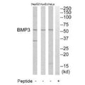 Western blot analysis of extracts from HeLa cells, HuvEc cells and HepG2 cells, using BMP3 antibody.