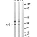 Western blot analysis of extracts from Jurkat cells and HeLa cells, using AIG1 antibody.