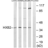 Western blot analysis of extracts from LOVO cells, A549 cells, HUVEC cells and MCF-7 cells, using HOXB2 antibody.