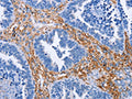 PLK1 Antibody – Figure 1 of 1