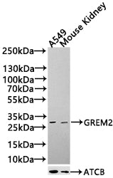 Western blot analysis of Mouse kidney, 293T, Mouse lung, antibody was diluted at 1000. Secondary antibody  was diluted at 1:20000