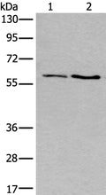 Gel: 8%SDS-PAGE, Lysate: 40 ug, Lane 1-2: Human cerebella tissue and Human cerebrum tissue lysates, Primary antibody: CSB-PA107772(SLC17A8 Antibody) at dilution 1/250, Secondary antibody: Goat anti rabbit IgG at 1/8000 dilution, Exposure time: 10 seconds