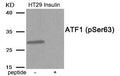 Western blot analysis of extracts from HT29 cells treated with Insulin using Phospho-ATF1 (Ser63) antibody.The lane on the right is treated with the antigen-specific peptide.