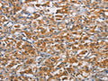 RICTOR Antibody – Figure 1 of 2