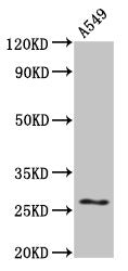 Western Blot
Positive WB detected in: A549 whole cell lysate
All lanes: HSPB1 antibody at 4ug/ml
Secondary
Goat polyclonal to rabbit IgG at 1/50000 dilution
Predicted band size: 23 kDa
Observed band size: 27 kDa