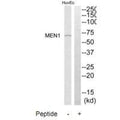 Western blot analysis of extracts from HuvEc cells, using MEN1 antibody.