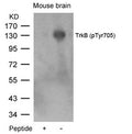 Western blot analysis of extracts from mouse brain tissue using TrkB(Phospho-Tyr705) Antibody and the same antibody preincubated with blocking peptide.