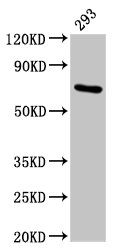 Western Blot
Positive WB detected in: 293 whole cell lysate
All lanes: HSPA1A antibody at 4.9µg/ml
Secondary
Goat polyclonal to rabbit IgG at 1/50000 dilution
Predicted band size: 71, 64 kDa
Observed band size: 71 kDa