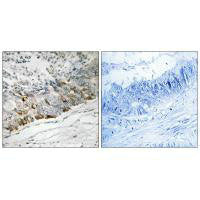 Immunohistochemistry analysis of paraffin-embedded human colon carcinoma tissue using GCHFR antibody.
