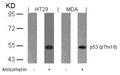 Western blot analysis of extracts from HT29 and MDA cells untreated or treated with anisomycin using p53(Phospho-Thr18) Antibody.