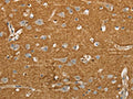 The image on the left is immunohistochemistry of paraffin-embedded Human brain tissue using CSB-PA109577(SLC1A2 Antibody) at dilution 1/20, on the right is treated with synthetic peptide. (Original magnification: ×200)