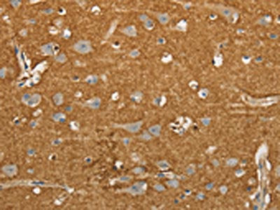 The image on the left is immunohistochemistry of paraffin-embedded Human brain tissue using CSB-PA109577(SLC1A2 Antibody) at dilution 1/20, on the right is treated with synthetic peptide. (Original magnification: ×200)