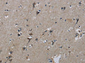 The image on the left is immunohistochemistry of paraffin-embedded Human brain tissue using CSB-PA110424(PIK3CB Antibody) at dilution 1/50, on the right is treated with synthetic peptide. (Original magnification: ×200)