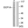 Western blot analysis of extracts from Jurkat cells, using DCP1A antibody.