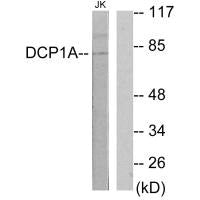 Western blot analysis of extracts from Jurkat cells, using DCP1A antibody.