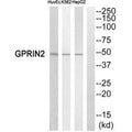 Western blot analysis of extracts from HuvEc cells,K562 cells and HepG2 cells, using GPRIN2 antiobdy.