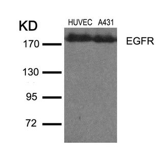 Western blot analysis of extracts from HUVEC and A431 cells using EGFR(Ab-1110) Antibody.